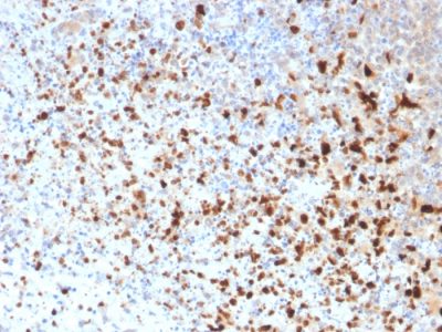 Herpes Simplex Virus 1 (HSV1) Monoclonal Mouse Antibody (10A3)