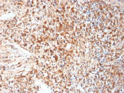 Herpes Simplex Virus 1 (HSV1) Monoclonal Mouse Antibody (HSVI/2095)