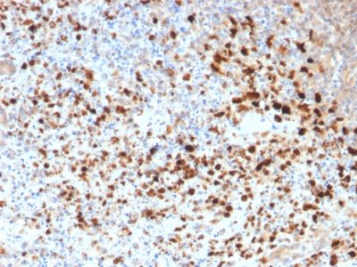Herpes Simplex Virus 1 (HSV1) Polyclonal Rabbit Antibody (N/A)