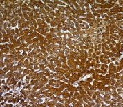 HIV p24 Monoclonal Mouse Antibody (p24/661)
