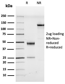 Human Herpes Virus 8 Monoclonal Rat Antibody (LN53)