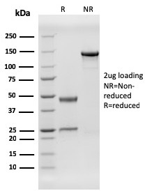 Human Herpes Virus 8 Recombinant Monoclonal Mouse Antibody (HHV8/3606)