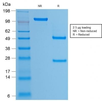 Human Papilloma Virus 16 (HPV-16) Recombinant Monoclonal Mouse Antibody (rHPV16L1/1058)