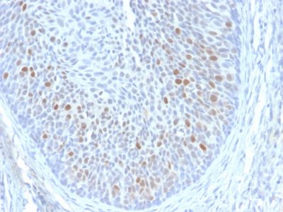 Human Papillomavirus 16 (HPV-16) E1/E4 Monoclonal Mouse Antibody (HPV16 E1/E4)