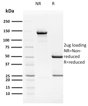 Human Papillomavirus 16 (HPV-16) E2 Monoclonal Mouse Antibody (TVG 261)