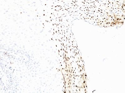 Human Papillomavirus 16 (HPV-16) Monoclonal Mouse Antibody (CAMVIR-1)