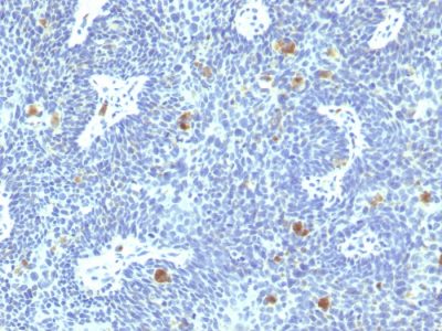 Human Papillomavirus 16 (HPV-16) Monoclonal Mouse Antibody (HPV16/1295)