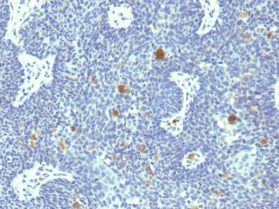 Human Papillomavirus 18 (HPV-18) Monoclonal Mouse Antibody (HPV18/1297)