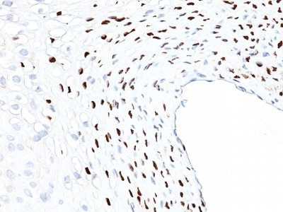 Human Papillomavirus-16 (HPV-16) Monoclonal Mouse Antibody (HPV16/1058)
