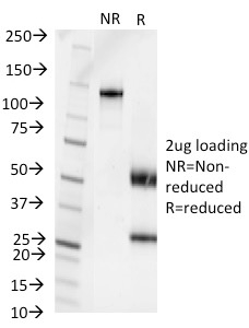 Pseudomonas Aeruginosa Serotype 6C Monoclonal Mouse Antibody (1200/472)