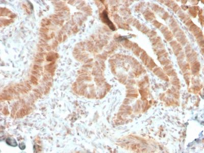 AKT1 Recombinant Monoclonal Mouse Antibody (rAKT1/2491)