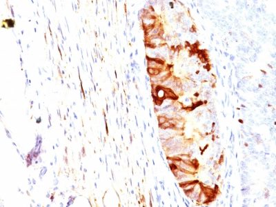 Aldehyde Dehydrogenase 1 Monoclonal Mouse Antibody (ALDH1A1/1382)
