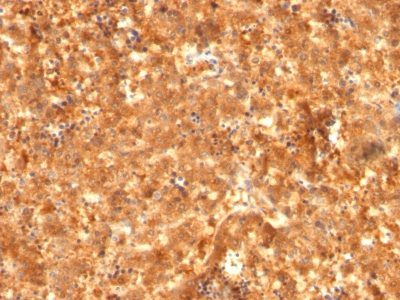 Alpha-Fetoprotein Monoclonal Mouse Antibody (C2 + C3 + MBS-12)