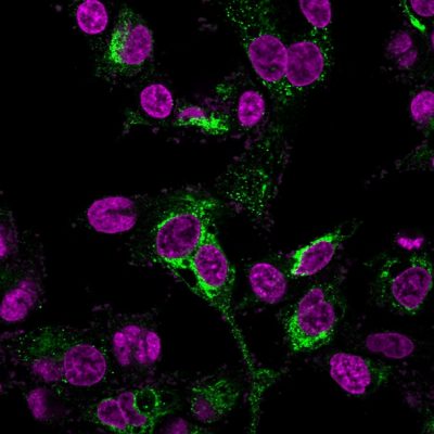 Alpha-Fetoprotein Monoclonal Mouse Antibody (C2 + C3 + MBS-12)