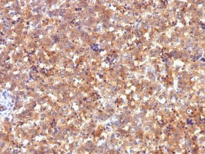 Alpha-Fetoprotein Monoclonal Mouse Antibody (C2)