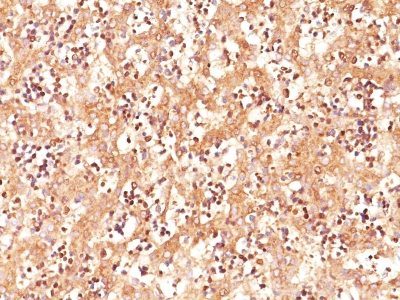 Alpha-Fetoprotein Monoclonal Mouse Antibody (C3)