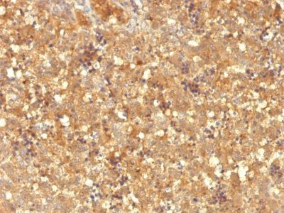Alpha-Fetoprotein Monoclonal Mouse Antibody (MBS-12)