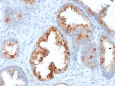 AMACR Monoclonal Mouse Antibody (AMACR/1864)