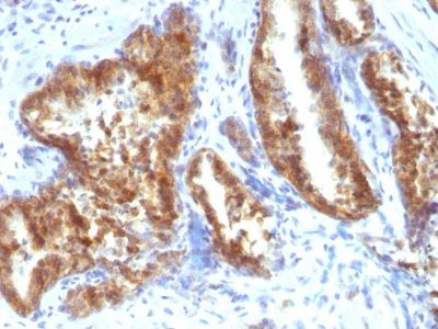 AMACR Polyclonal Rabbit Antibody (PAb)