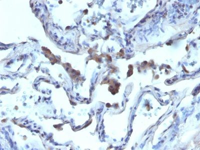 AMACR Polyclonal Rabbit Antibody (PAb)