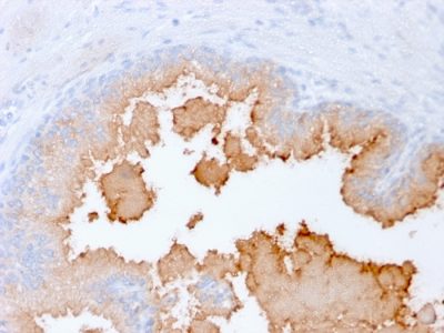 AMACR Recombinant Monoclonal Mouse Antibody (rAMACR/1864)