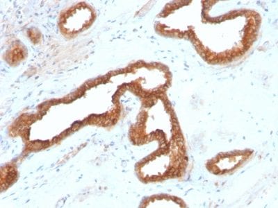AMACR Recombinant Monoclonal Rabbit Antibody (AMACR/2748R)