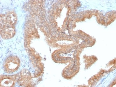 AMACR Recombinant Monoclonal Rabbit Antibody (AMACR/2748R)