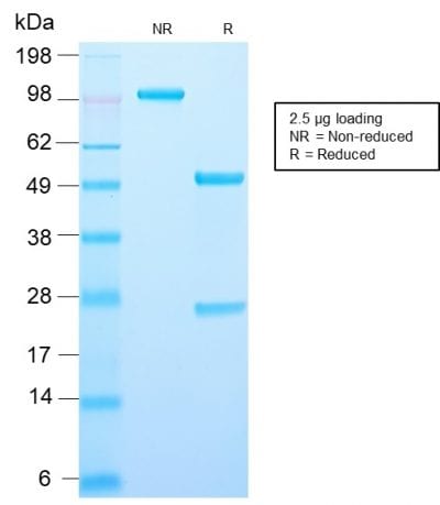 AMACR Recombinant Monoclonal Rabbit Antibody (AMACR/2748R)