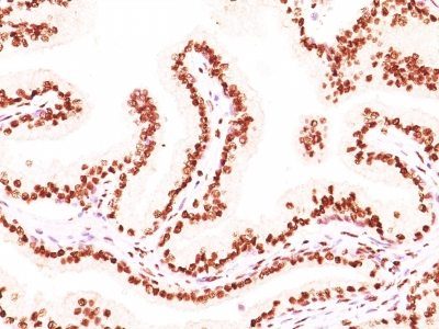 Androgen Receptor Monoclonal Mouse Antibody (AR441 + DHTR/882)