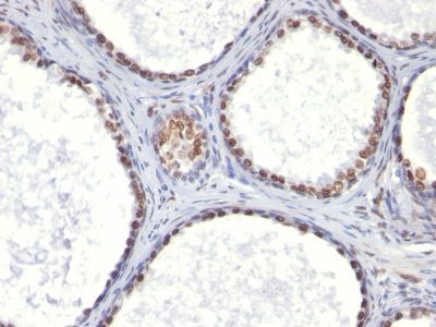 Androgen Receptor Monoclonal Mouse Antibody (AR441)