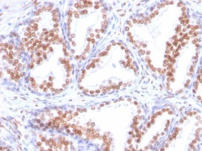 Androgen Receptor Monoclonal Mouse Antibody (DHTR/882)