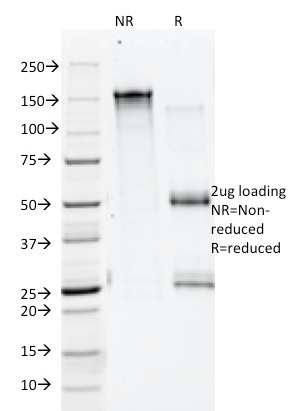 Annexin A1 Monoclonal Mouse Antibody (5E4/1)