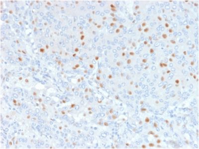 Annexin A1 Monoclonal Mouse Antibody (6E4/3)