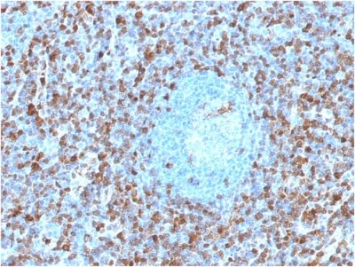Annexin A1 Monoclonal Mouse Antibody (ANXA1/1671)