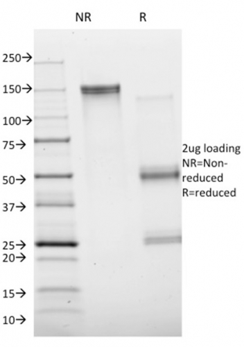 Annexin A1 Monoclonal Mouse Antibody (ANXA1/1672)