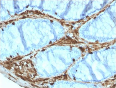 Annexin A1 Monoclonal Mouse Antibody (ANXA1/3566)