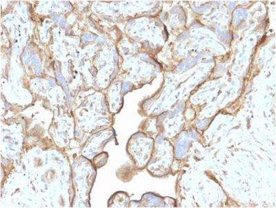 Annexin A1 Monoclonal Mouse Antibody (CPTC-ANXA1-1)