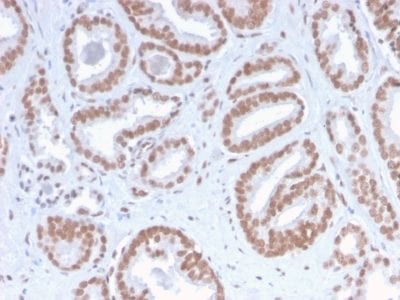 ATRX Recombinant Monoclonal Rabbit Antibody (ATRX/2900R)