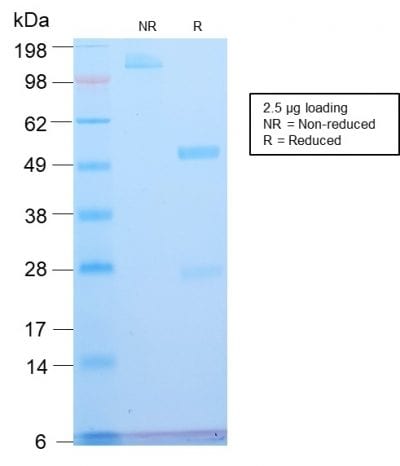 ATRX Recombinant Monoclonal Rabbit Antibody (ATRX/2900R)