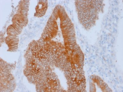 Aurora Kinase B Monoclonal Mouse Antibody (AURKB/1592)