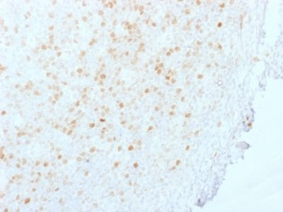 Aurora Kinase B Monoclonal Mouse Antibody (AURKB/1845)