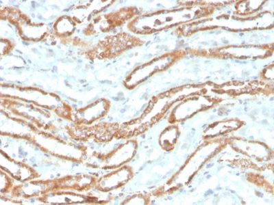 Aurora Kinase B Recombinant Monoclonal Mouse Antibody (rAURKB/1592)