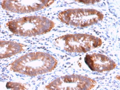 Aurora Kinase B Recombinant Monoclonal Rabbit Antibody (AURKB/3121R)