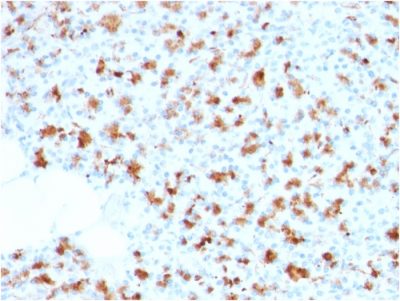 BARX1 Monoclonal Mouse Antibody (BARX1/2759)