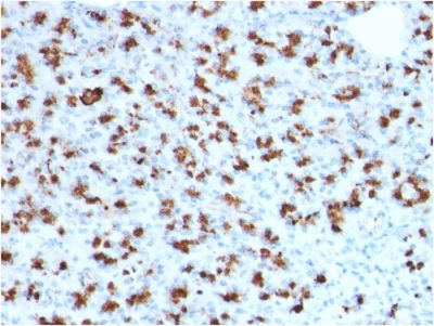 BARX1 Monoclonal Mouse Antibody (BARX1/2760)