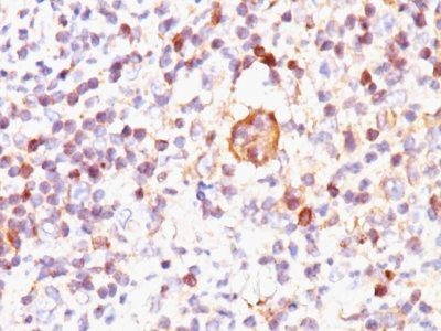 Bax Monoclonal Mouse Antibody (2D2)