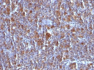 Bax Monoclonal Mouse Antibody (BAX/962)