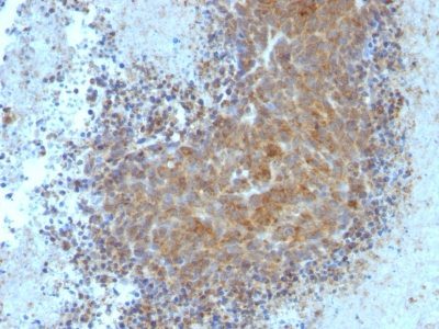 Bax Monoclonal Mouse Antibody (BAX/962)