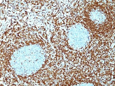 Bcl-2 Monoclonal Mouse Antibody (100/D5 + 124)