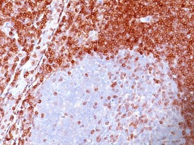 Bcl-2 Monoclonal Mouse Antibody (100/D5)